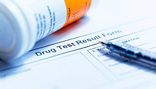 Urine drug screening test